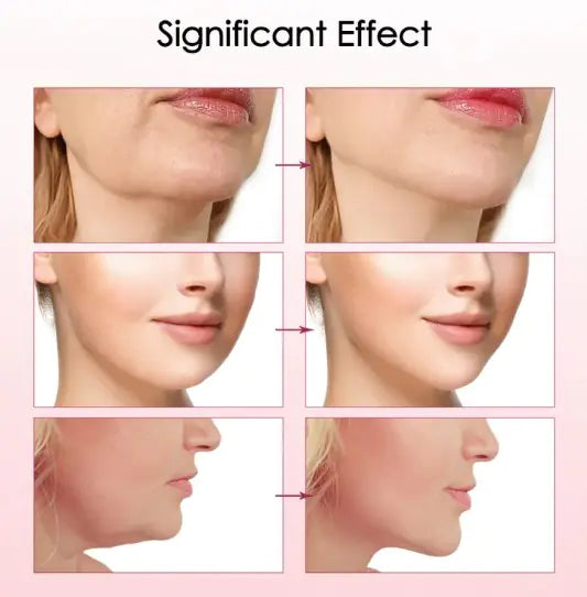 Zerosell™ - Facial Lifting